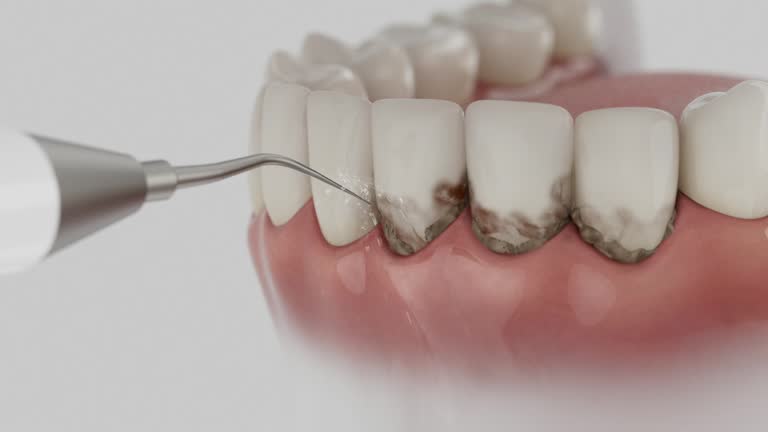 Reliable Dental contractor in Salisbury, MO by Smile Center Dentistry